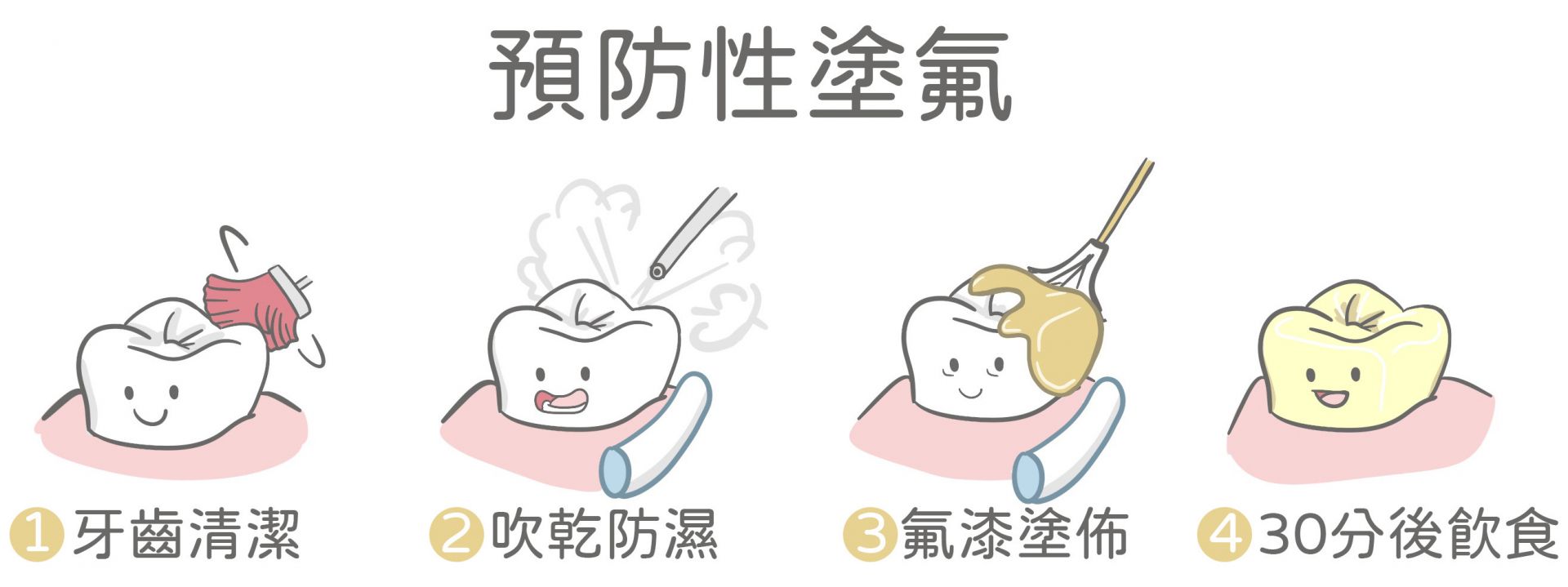 預防性塗氟
