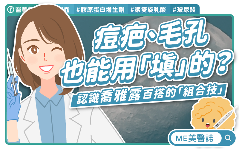 痘疤、毛孔也能用填的？喬雅露「膠原蛋白」解鎖飽滿肌秘訣！