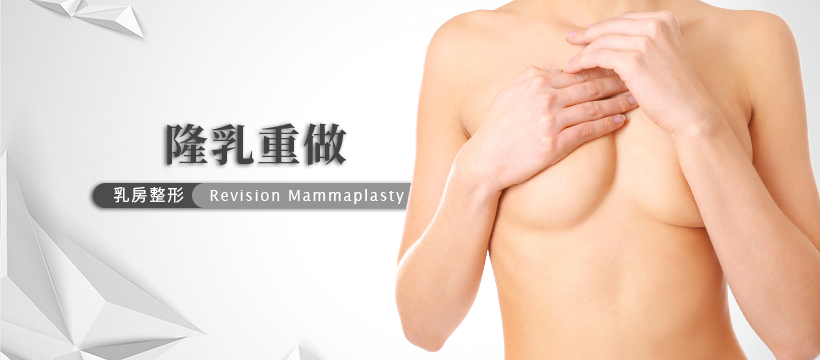 隆乳重做